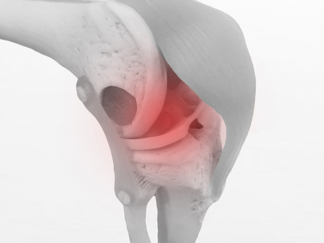 【大阪市住吉区】整形外科のリハビリ・半月板損傷の場合