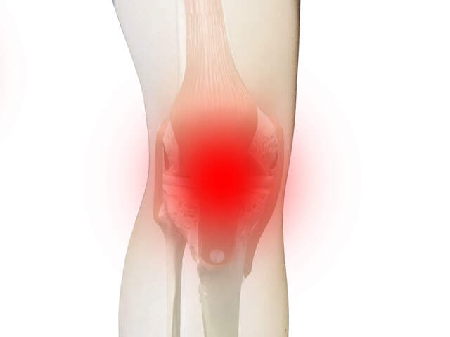 膝の内側が痛いのはなぜ?考えられる病気・症状